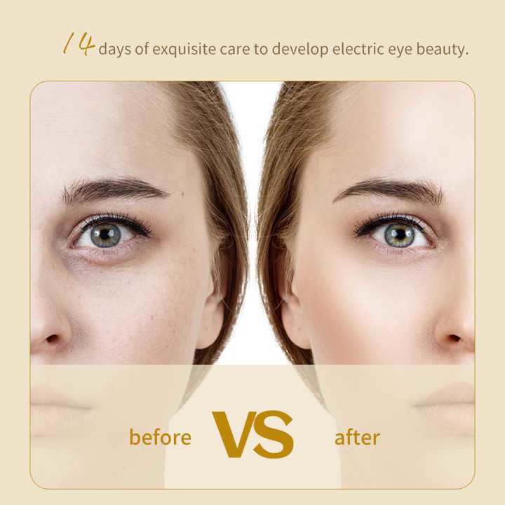 OEM 24 คาราททอง สับสนดูแลผิวหน้า หน้ากากตา ครีมกําจัดริ้วรอย ธาตุอินทรีย์