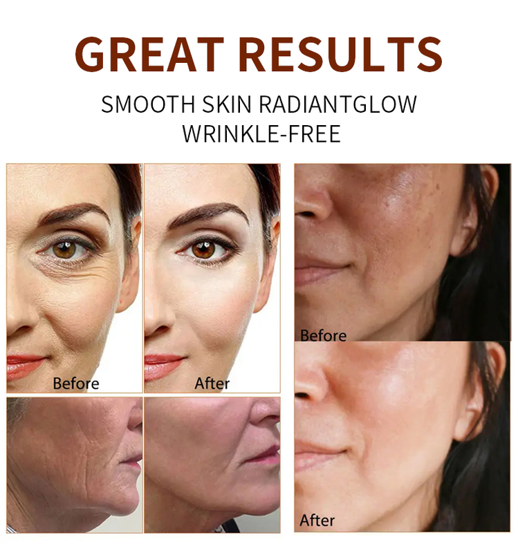 PH5.5 Balanced Skincare Face Serum Niacinamide Serum Sensitive Skin For Dark Circles Swelling