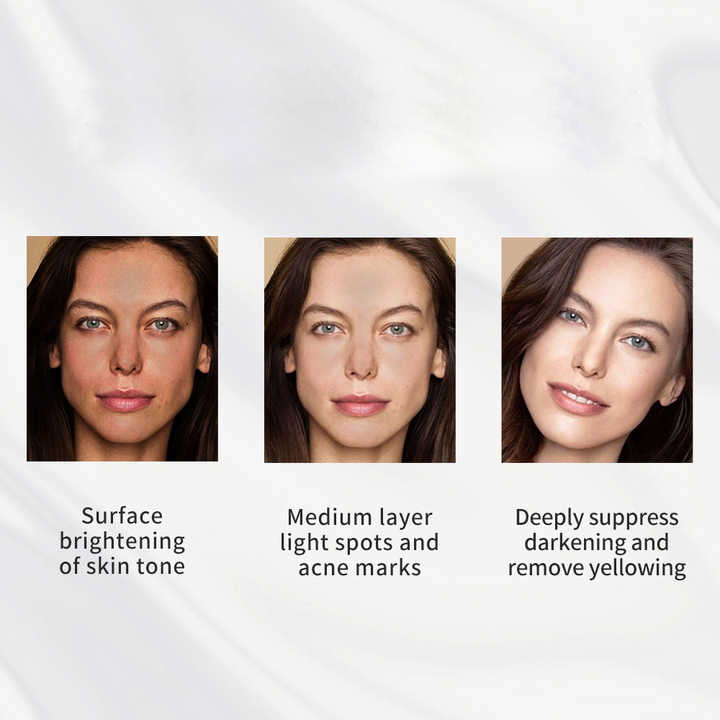 OEM Natürliche Hautfleckenentferner Vitamin C Bio Hautpflege Geschenksets Produkte Aufhellen Feuchtigkeitsspender