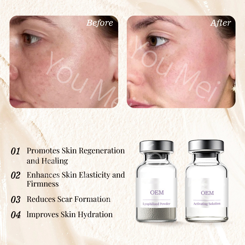 OEM ODM Custom Wholesale Collagen Hydration Repair Wrinkle-Removing Anti-Aging Serum for Whitening, Pigmentation Removal, and Skin Repair