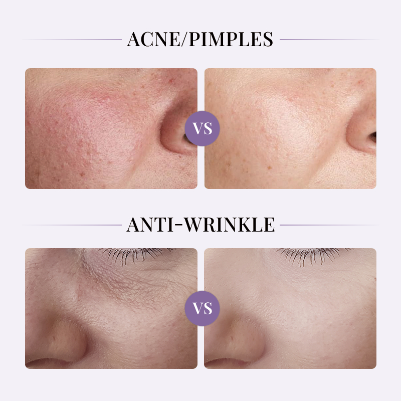 OEM ODM disposable strong hydration nourishing wrinkle removing collagen ointment firming anti wrinkle repair whitening spot removing essence