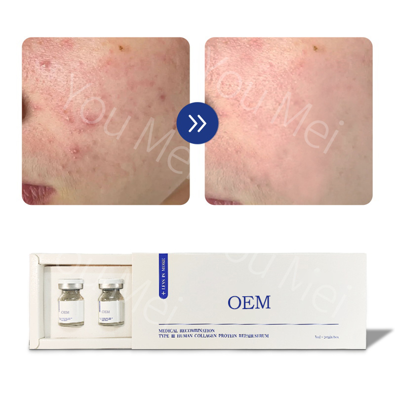 OEM ODM Strong Hydrating Moisturizing Serum Small Bottle Hyaluronic Acid Acne Treatment Skin Serum