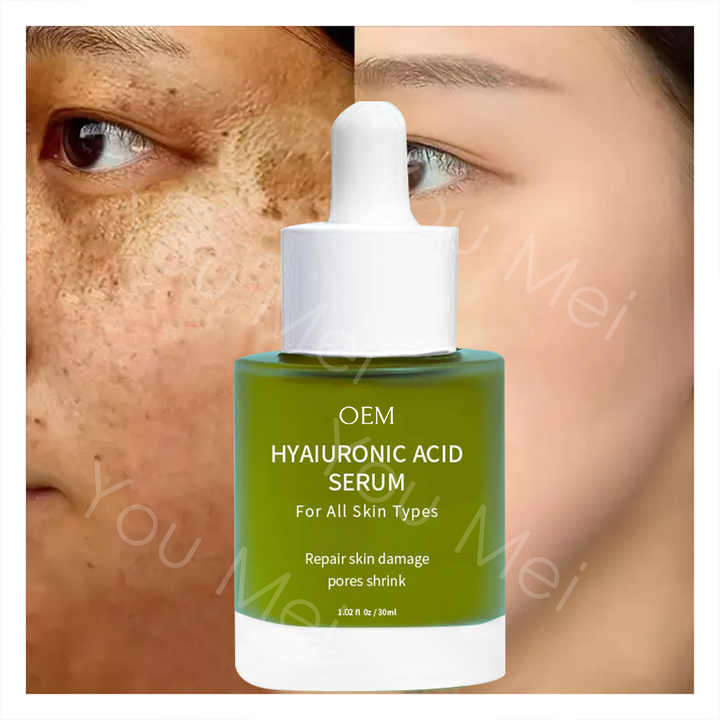 Tea Tree AHA Vitamin E Skincare Face Serum Essence For Hydration Black Spots