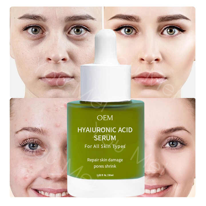 Tea Tree AHA Vitamin E Skincare Face Serum Essence For Hydration Black Spots