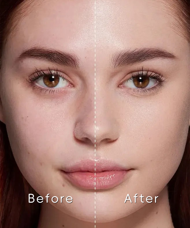 ODM OEM Private Label Skin Care Serum Aloe Vera and Avocado Oil for Acne Control Translucent Brightening and Refining