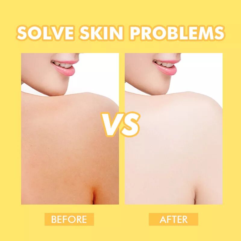 Customized Shea Butter Body Care Lotion Containing Glycolic Acid And Peptide Containing Tranexamic Acid