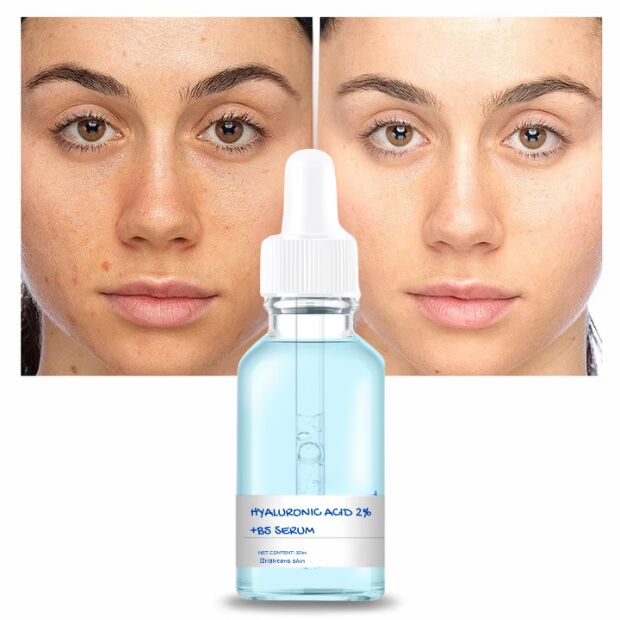 OEM ODM hyaluronic acid facial essence deep moisturizing skin care anti wrinkle whitening body fluid shape essence serum