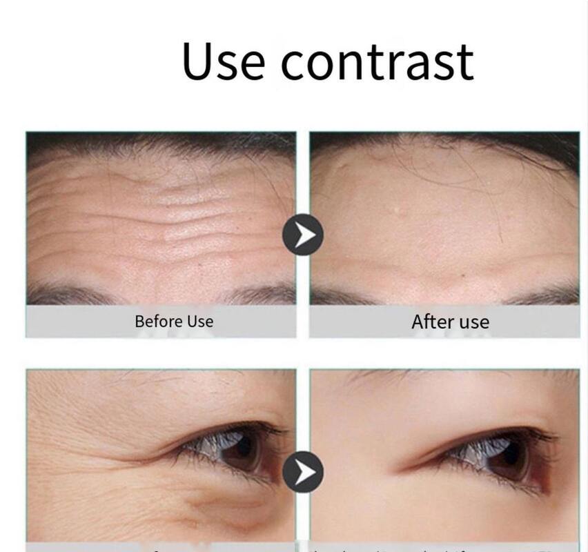 OEM ODM Customizable Ingredients Anti-Aging Anti-Wrinkle Whitening Hydrating Lactic Acid Bacteria Essence Serum