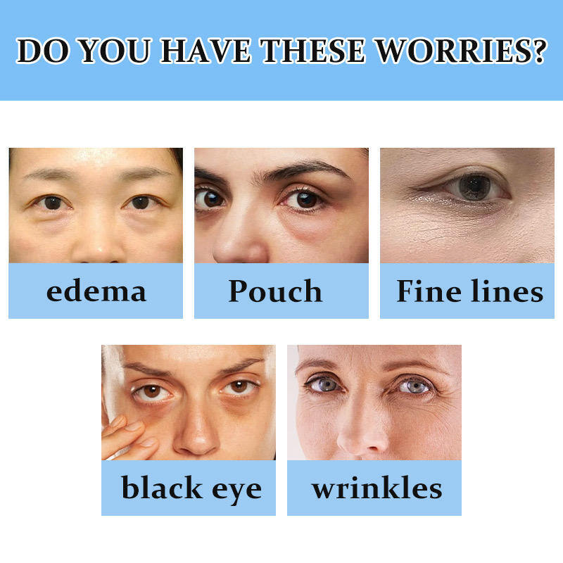 OEM ODM Quick Eye Lifting Anti-Aging Skincare Serum 5% with Coffee Essence Aloe Vera Eye Cream Roller Facial Care