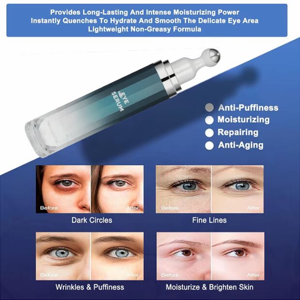 OEM ODM Quick Eye Lifting Anti-Aging Skincare Serum 5% with Coffee Essence Aloe Vera Eye Cream Roller Facial Care