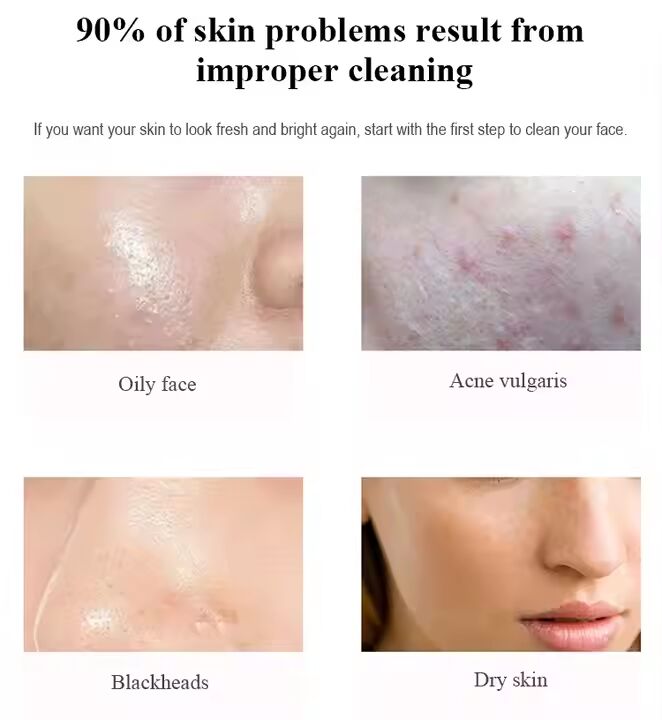 Mousse Detergente Schiuma per il Viso con Tea Tree per Pelli Sensibili, Detergente Struccante, Esfoliante, Nutriente - Formula Personalizzabile OEM ODM