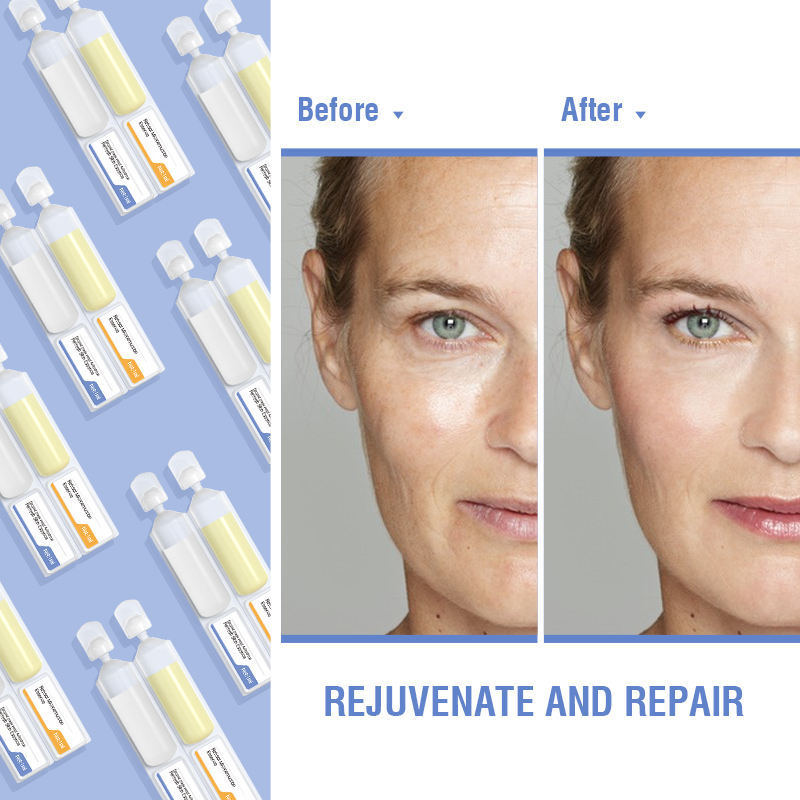 OEM ODM customized hot selling retinol peptide vitamin E, vitamin C anti-aging wrinkle removal fine lines crow foot facial serum toner