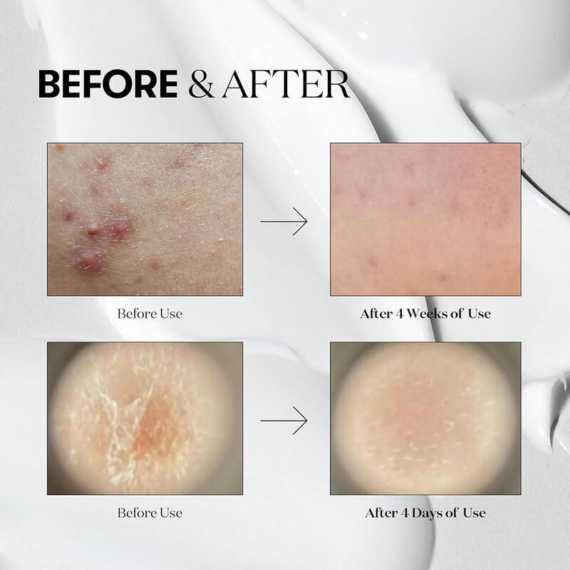 OEM ODM Natural Skincare Products Micro Needle Serum Centalla Soothing Repair Skincare Products Facial Care