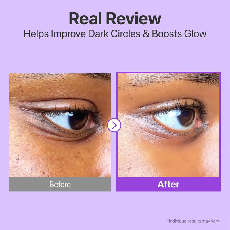 OEM ODM Electric Eye Cream Nad+Retinal Peptide Niacinamide Brightening and Whitening Dark Eye Circles Light Spot Eye Cream Anti Wrinkle and Eye Bag Removal