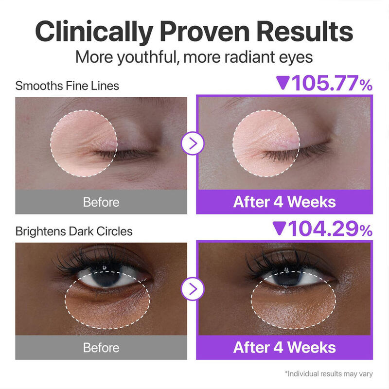 OEM ODM Electric Eye Cream Nad+Retinal Peptide Niacinamide Brightening and Whitening Dark Eye Circles Light Spot Eye Cream Anti Wrinkle and Eye Bag Removal