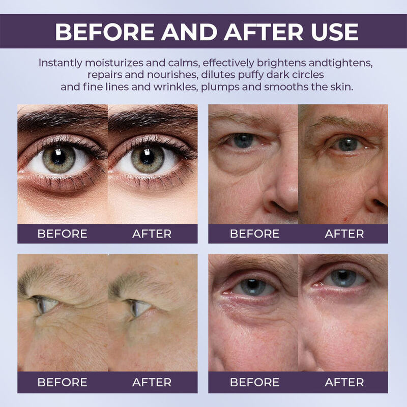 OEM ODM Pure Vegan Eye Roller Essence for Puffiness Reduction, Anti-Aging, Brightening, Caffeine, Massage, Repair, and Dark Circle Essence