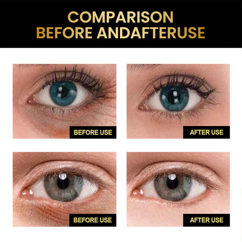 OEM ODM Custom Luxury Caviar Firming Eye Cream for Wrinkles and Puffiness Anti-Aging Private Brand Eye Cream