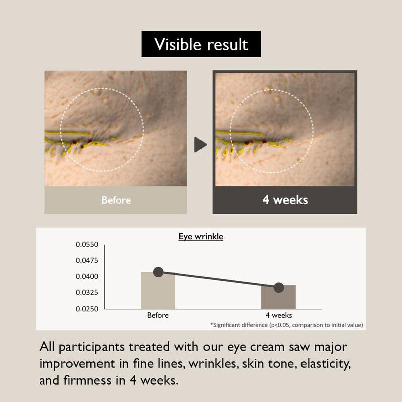 OEM ODM Natural Black Rice Bakuchiol Eye Cream Private Label Anti-Aging Wrinkle Fine Line Dark Circles Remover Firming Eye Cream
