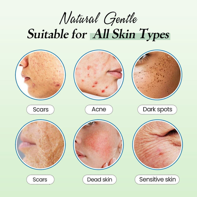 OEM ODM skincare products salicylic acid niacinamide facial mask acne-fighting oil-control cleansing pad suitable for all skin types