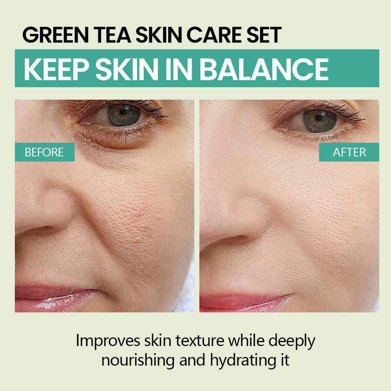 OEM ODM Brand Customized Korean Anti acne Cleansing Pad Oil Control Green Tea Lactoglycolic Acid Soothing Cotton facial mask