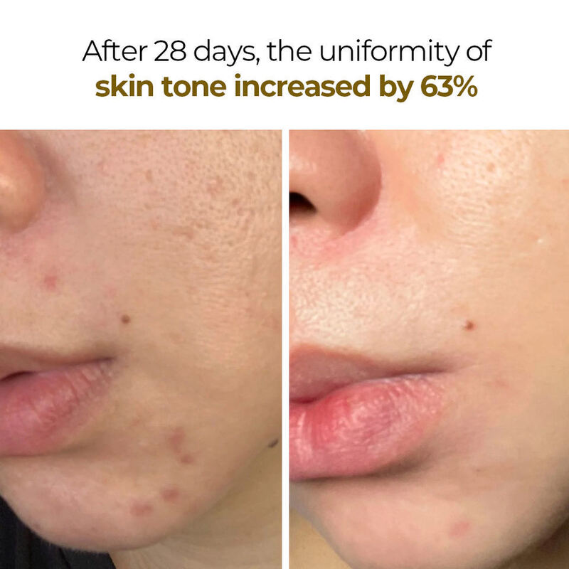 OEM DOM brand customized women's organic non cruel skin whitening facial mask freckle removing gel facial mas