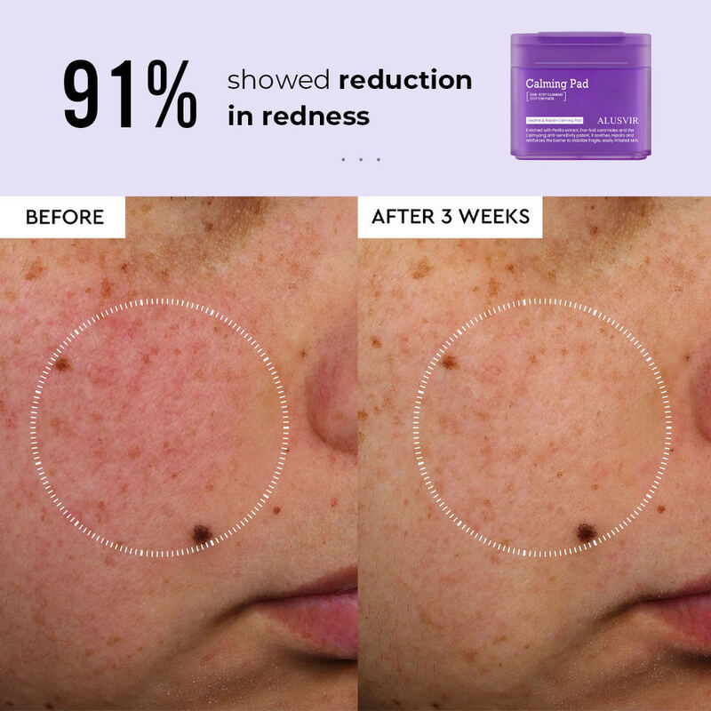 OEM ODM Brand Skincare Perilla Ceramide Soothing Hydrating Toner Facial Mask Hydrating Cleansing Pad Facial Mask