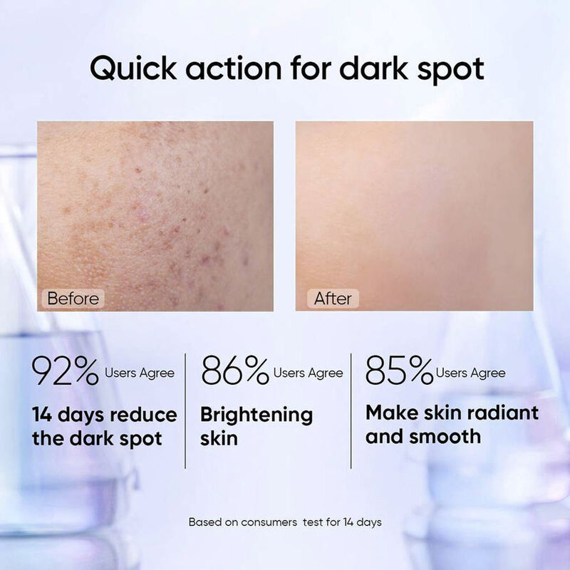 OEM ODM 377 Nicotinamide Spot-Free Facial Essence Brand-Owned Skincare Brightens and Smooths Skin Women's Facial Essence