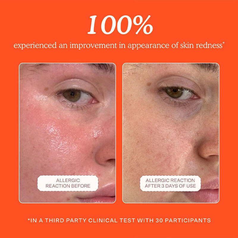 OEM ODM brand hypochlorite spray reduces redness, relieves swelling, moisturizes, calms skin care products, facial toner spray