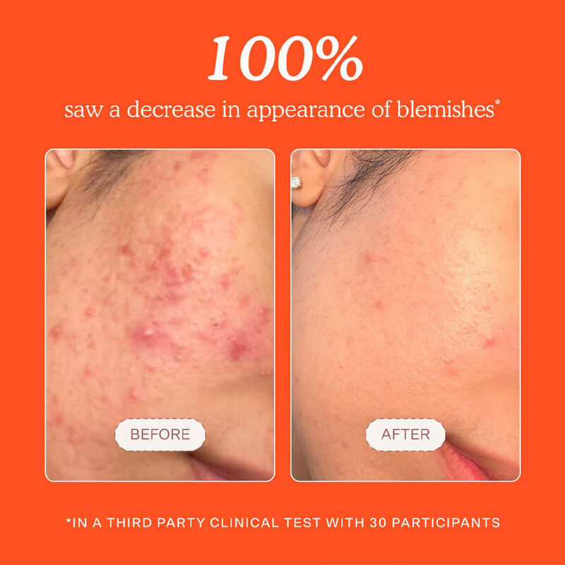 OEM ODM brand hypochlorite spray reduces redness, relieves swelling, moisturizes, calms skin care products, facial toner spray