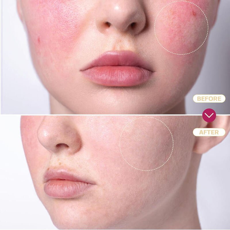 OEM ODM Brand Natural Hypochlorous Acid Spray for Hydration, Moisturizing, Soothing, Calming, Brightening, Acne Removal, Redness Reduction, and Facial Toner