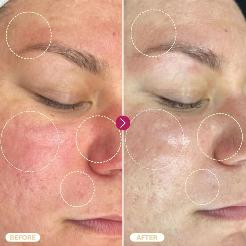 OEM ODM Brand Natural Hypochlorous Acid Spray for Hydration, Moisturizing, Soothing, Calming, Brightening, Acne Removal, Redness Reduction, and Facial Toner