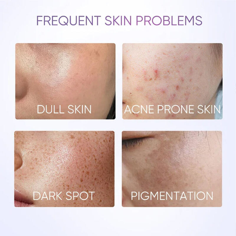 OEM ODM brand customized essence 377 whitening, brightening and spot lightening facial essence whitening serum