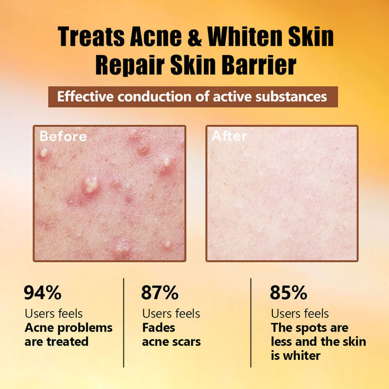 OEM ODM Korean Brand Customization Hyaluronic Acid Facial Essence Moisturizer with 15um Microparticles for Whitening, Acne Treatment, and Facial Repair Essence