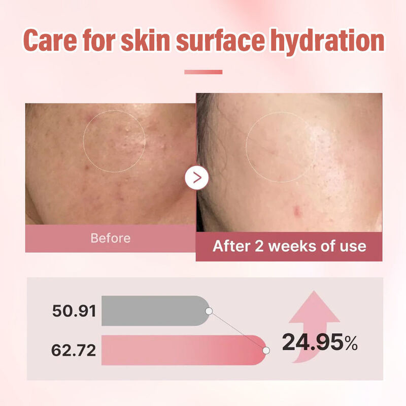 OEM ODM Korean Pdrn Collagen Microcapsule Anti-Aging Facial Essence Skincare Hydration Firming Facial Essence for Mature Skin Liquid Form