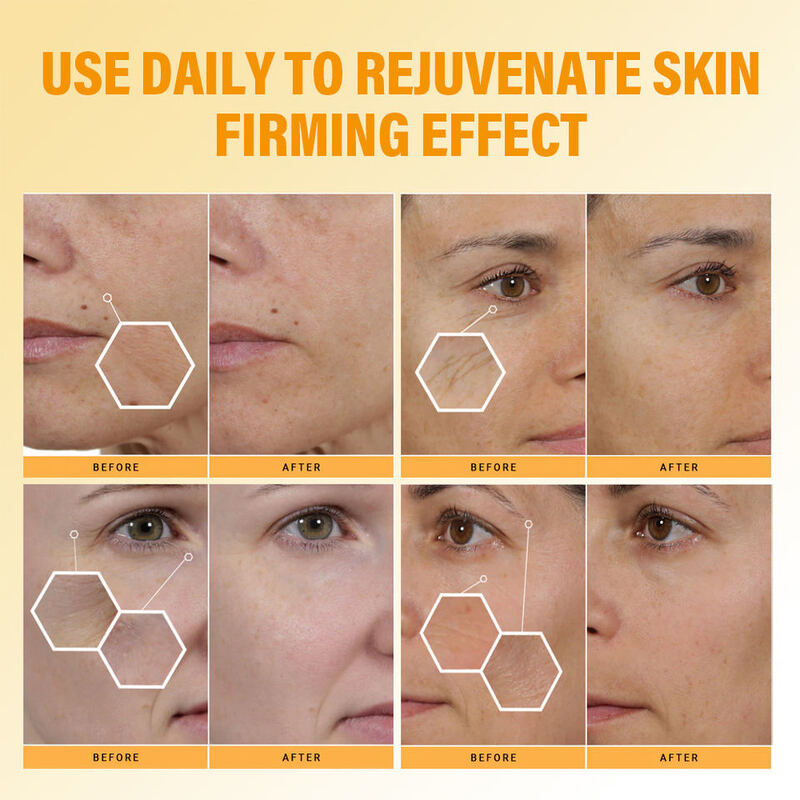 OEM ODM Korean Brand Custom Face Cream Essence Set Bee Venom Cream Anti-Wrinkle Hydrating Face Cream Reduce Fine Lines Brighten Facial Moisturizing Set