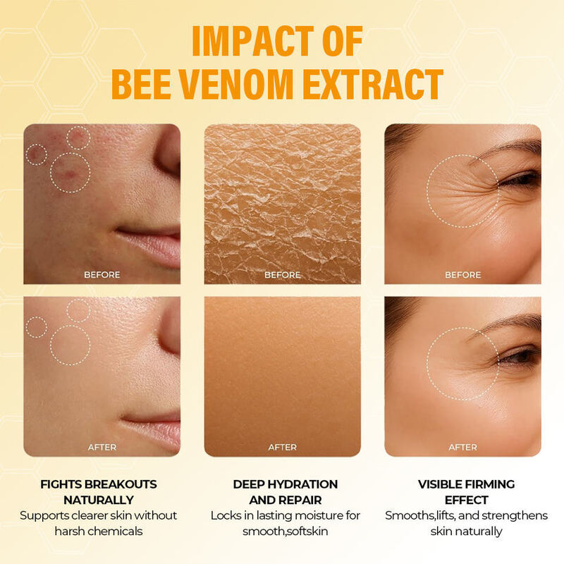 OEM ODM Korean Brand Custom Face Cream Essence Set Bee Venom Cream Anti-Wrinkle Hydrating Face Cream Reduce Fine Lines Brighten Facial Moisturizing Set
