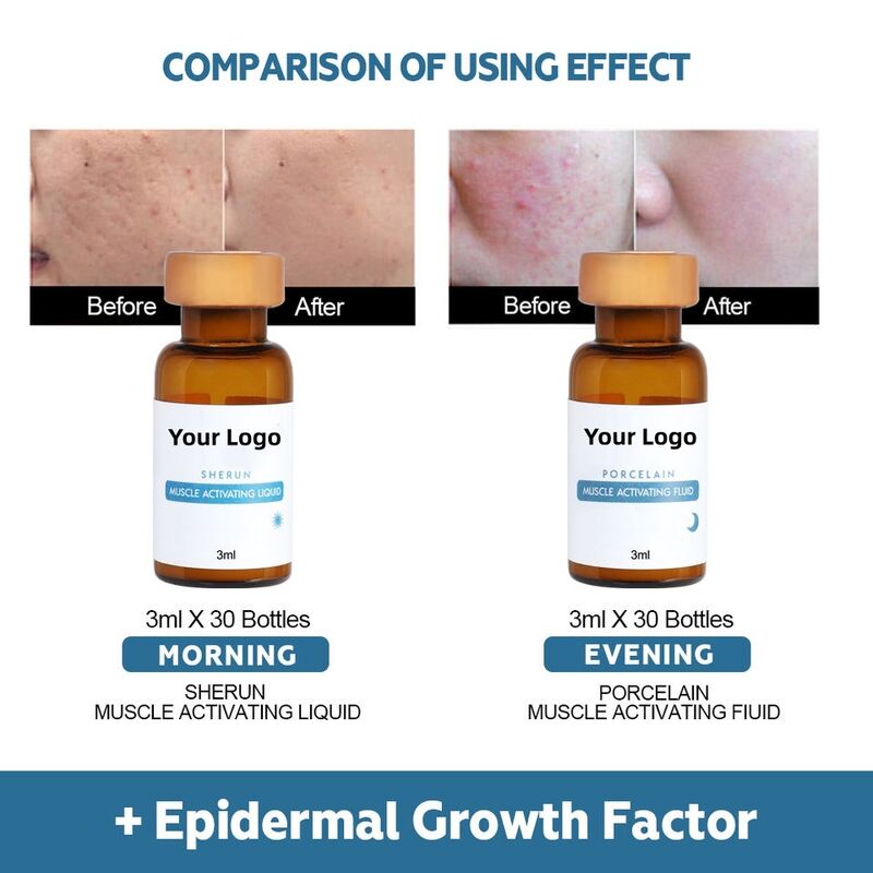 OEM ODM customized brand skin care epidermal growth factor freeze-dried facial essence firming moisturizing cream anti-aging and anti wrinkle facial essence set