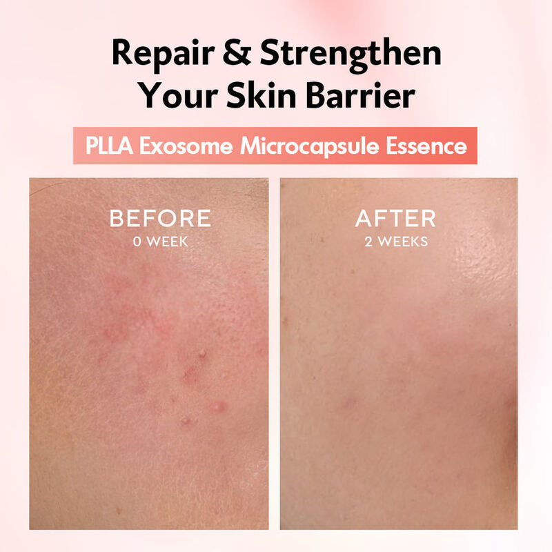OEM ODM Korean Skincare Lactic Acid Facial Serum Anti-Wrinkle Tightening Essence for Mature Skin