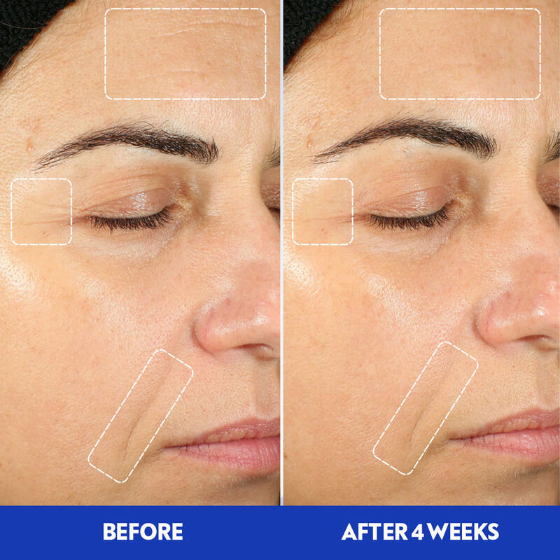 OEM ODM Brand Skincare Products Poly-L-lactic Acid Hyaluronic Acid Peptide Collagen Facial Serum Anti aging Skin Brightening and Whitening Skin