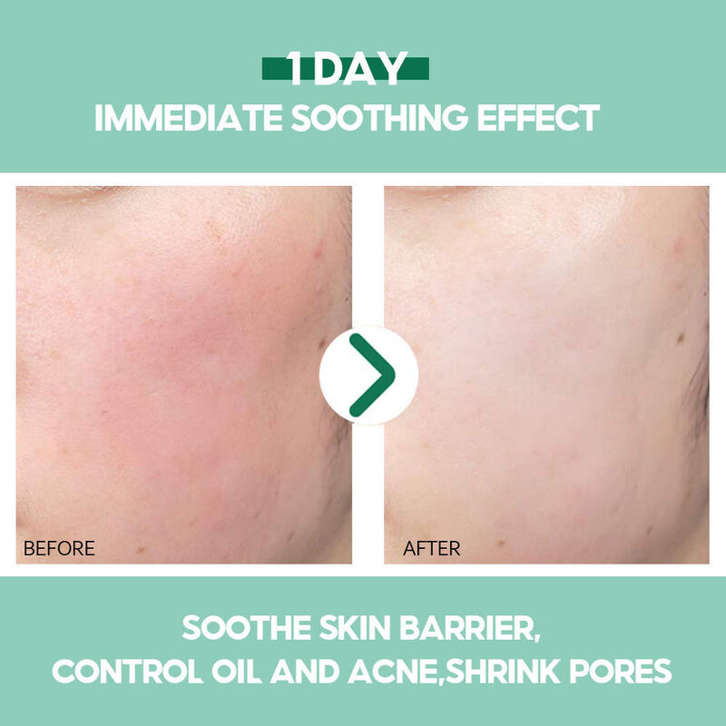 OEM ODM customized Aloevera gel, a Korean private brand, organically soothes 99% pure aloe moisturizing face cream, moisturizes, moisturizes and tender skin