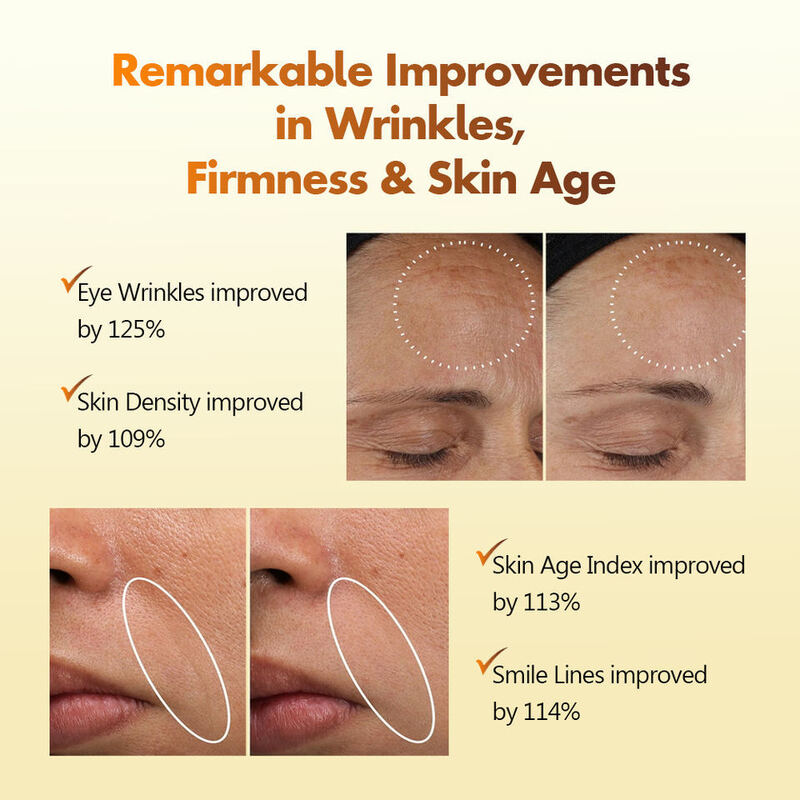 OEM ODM Korean brand customized facial blood serum vegan liquid skincare niacinamide whitening anti wrinkle skincare products facial soothing serum