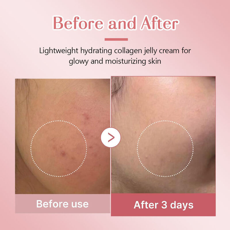 OEM ODM Korean version collagen facial moisturizing cream, vitamin E facial jelly cream, skincare products, plump wrinkles, firm skin