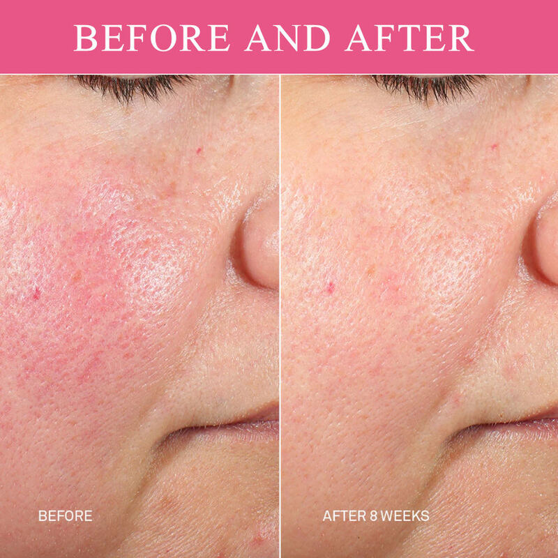 OEM ODM Brand Custom Luxury Whitening Skincare Essence Micro Pearl Essence for Women Rose Face Anti-Aging Whitening Facial Essence Product