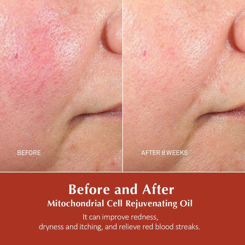OEM ODM brand customized liquid double tube essence hyaluronic acid mitochondrial cell anti-aging anti wrinkle moisturizing repair skin care product