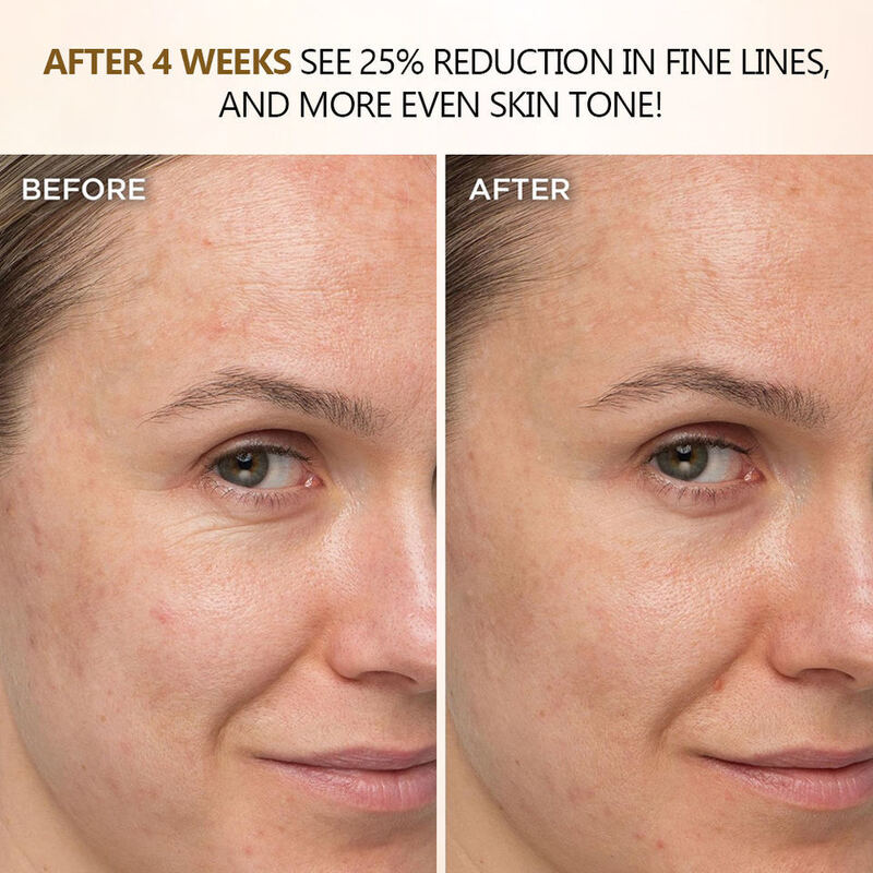 OEM ODM Brand Customized Retinol Alpha Hydroxy Acid Face Cream Brightening Nourishing Anti-Aging Facial Hydrating Skin