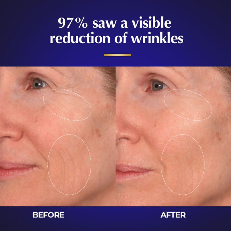 OEM ODM Korean skin care set Anti wrinkle exocrine liposome Mitochondria Anti aging Firming Collagen promoting face cream toner Facial essence for facial skin care
