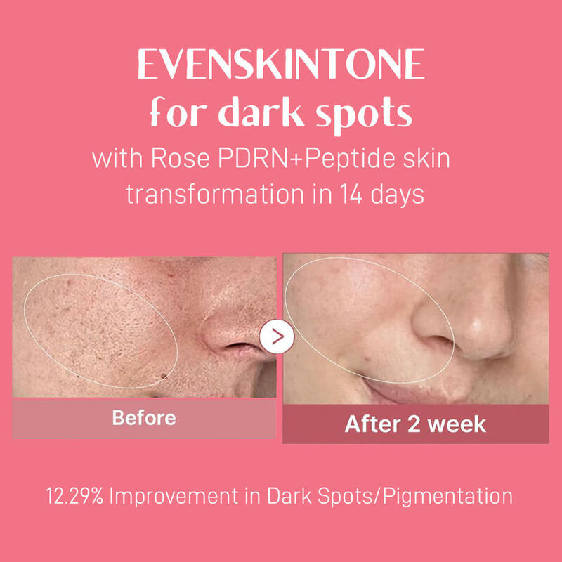 OEM ODM Korean Rose PDRN Niacinamide Peptide Pink Facial Toner Private Label Anti-Aging Brightening Facial Toner Skincare Product