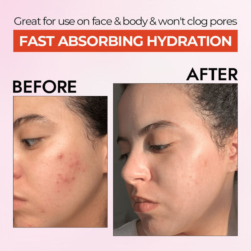 OEM ODM Korean natural acne skin care brand moisturizing gel face cream anti-aging skin care cream suitable for face and body