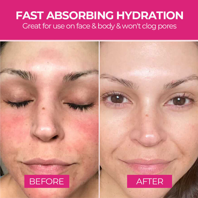 OEM ODM Korean Brand Skin Care Cream Moisturizing face cream Moisturizing Acne Skin Care Products Whitening Anti aging Firming Cosmetic Moisturizing Cream