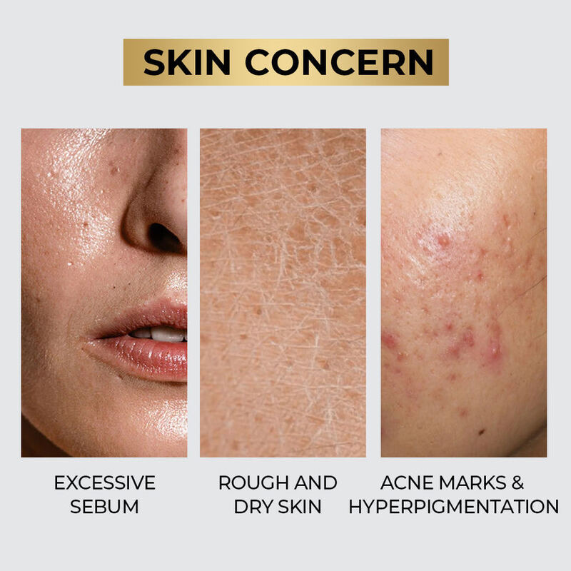 OEM ODM Brand ExosomeFacial Serum essence Nicotinamide Anti aging Acne Control Centella B5 AHA+BHA+PHA Pore Shrinkage Oil Skin Care Serum
